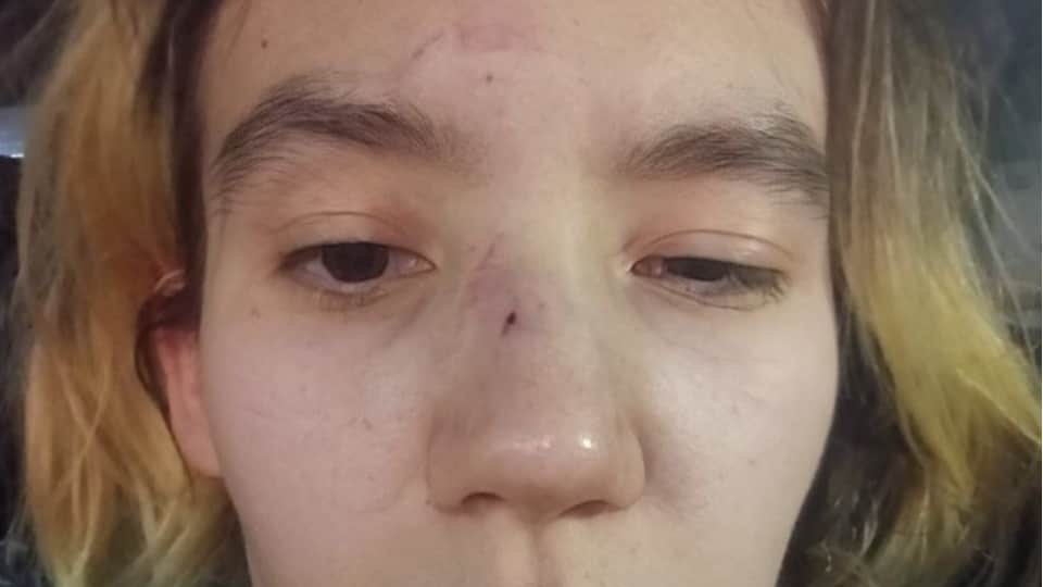 Campaign manager from Russia’s anti-war party says she was assaulted by Ukraine war veterans